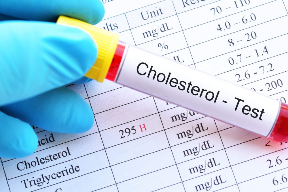 Hypothyroidism
