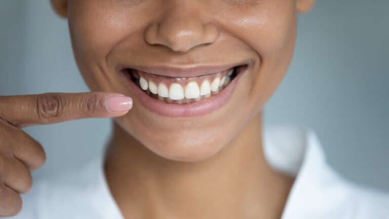 Gum health