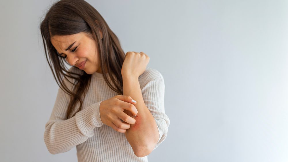 itchy skin