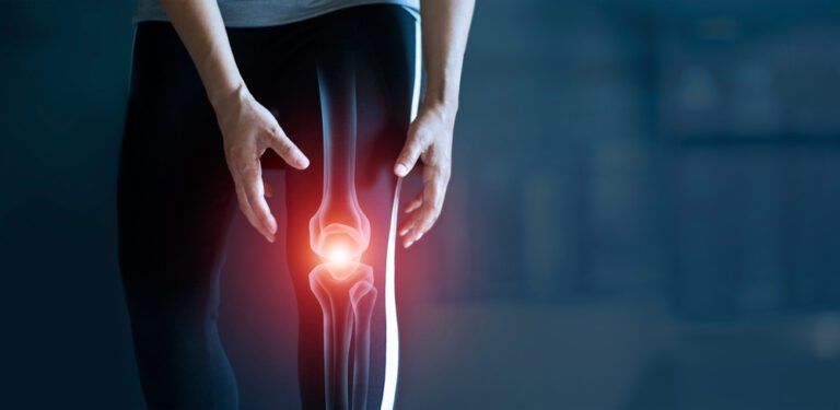 arthritis