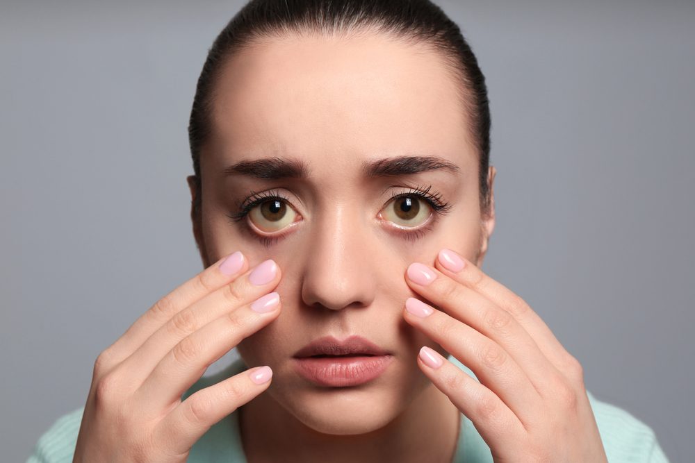 eye exam, too dehydrated
