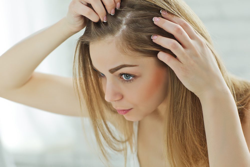 hair loss