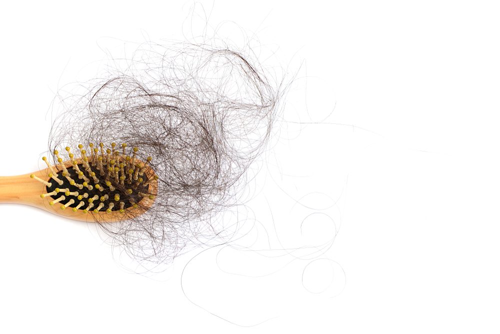 hair loss
