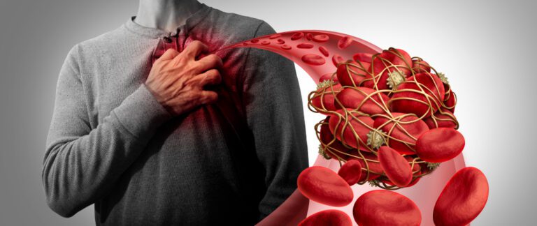 blood clot, covid