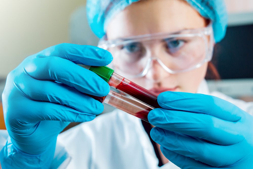 blood test