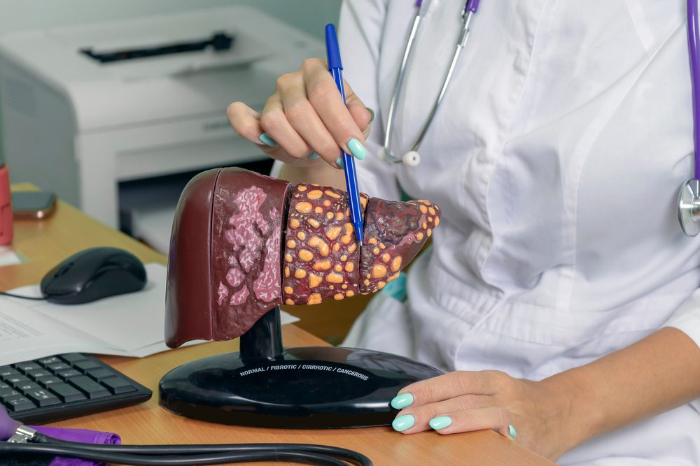 Liver Failure, early stage