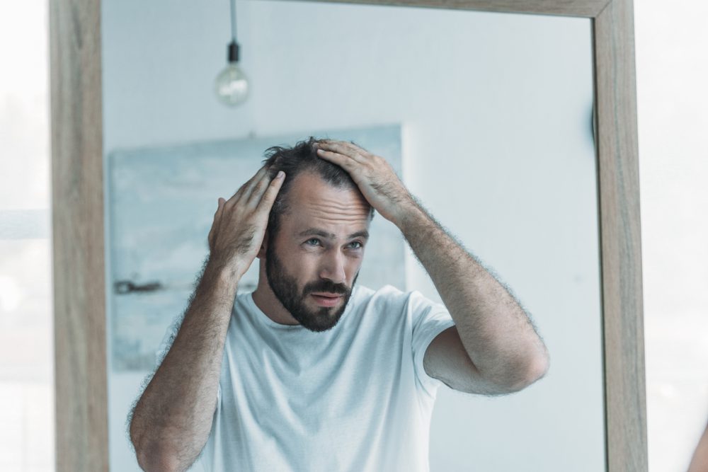 hair loss