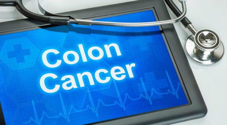 Colon Cancer