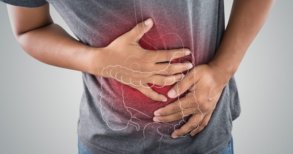 Colon Cancer