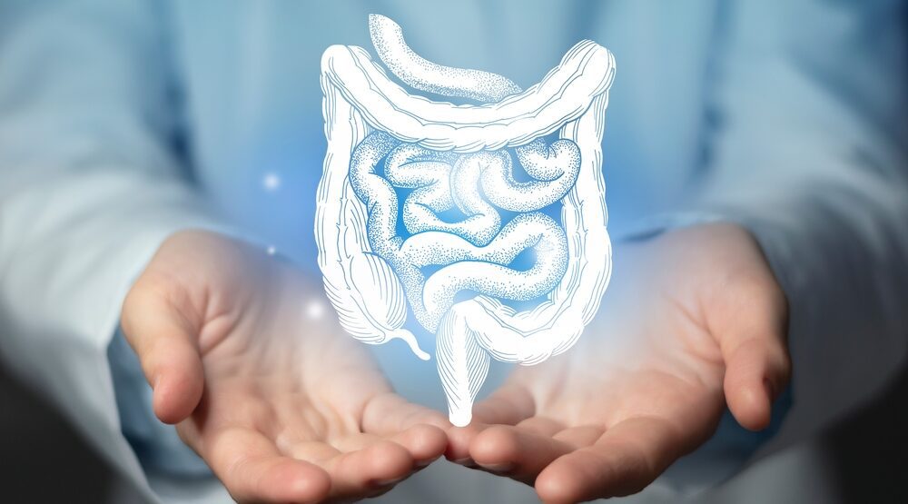 Colon Cancer