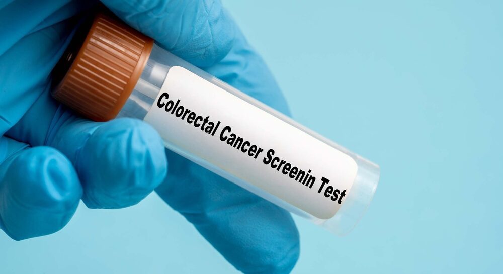 Colon Cancer