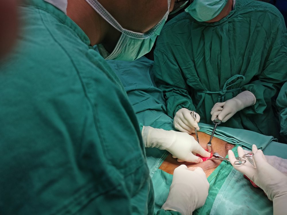 hernias