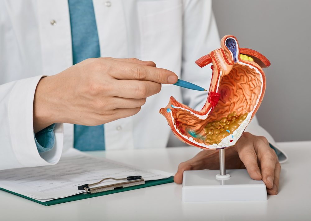 helicobacter pylori