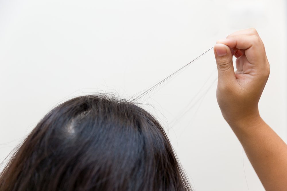 hair loss