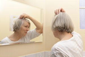 hair loss skin