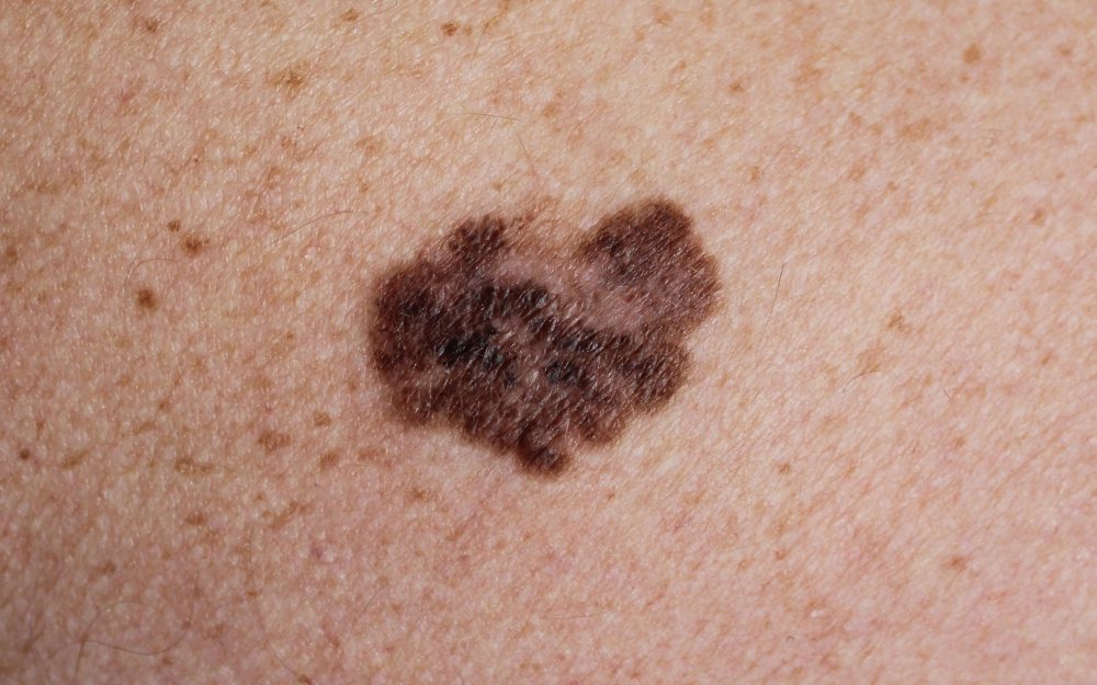 skin