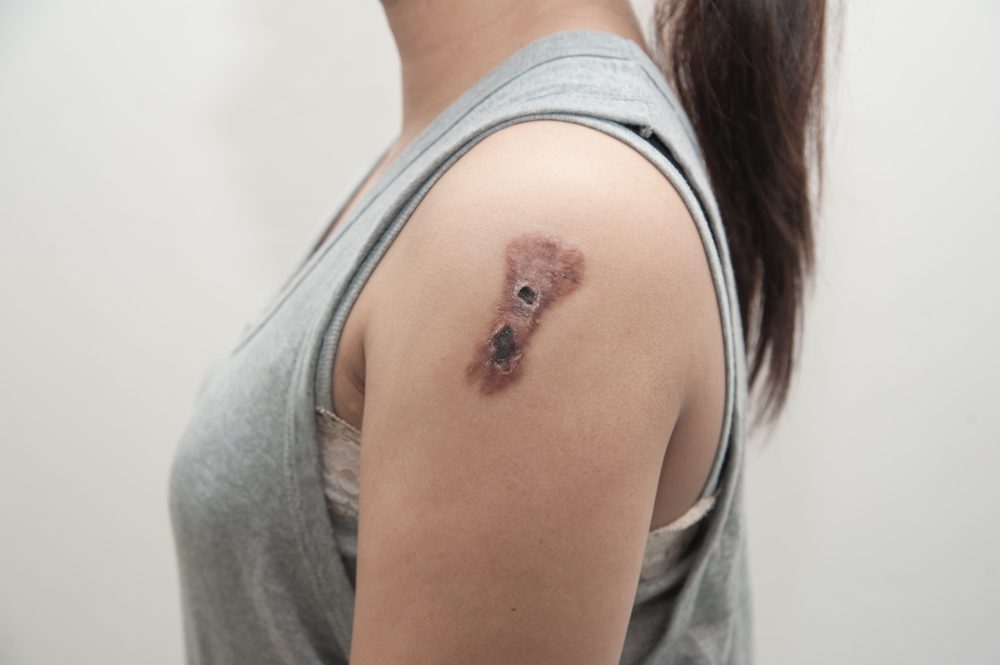 skin