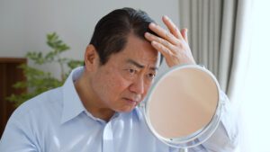 hair loss