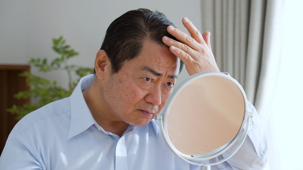 hair loss