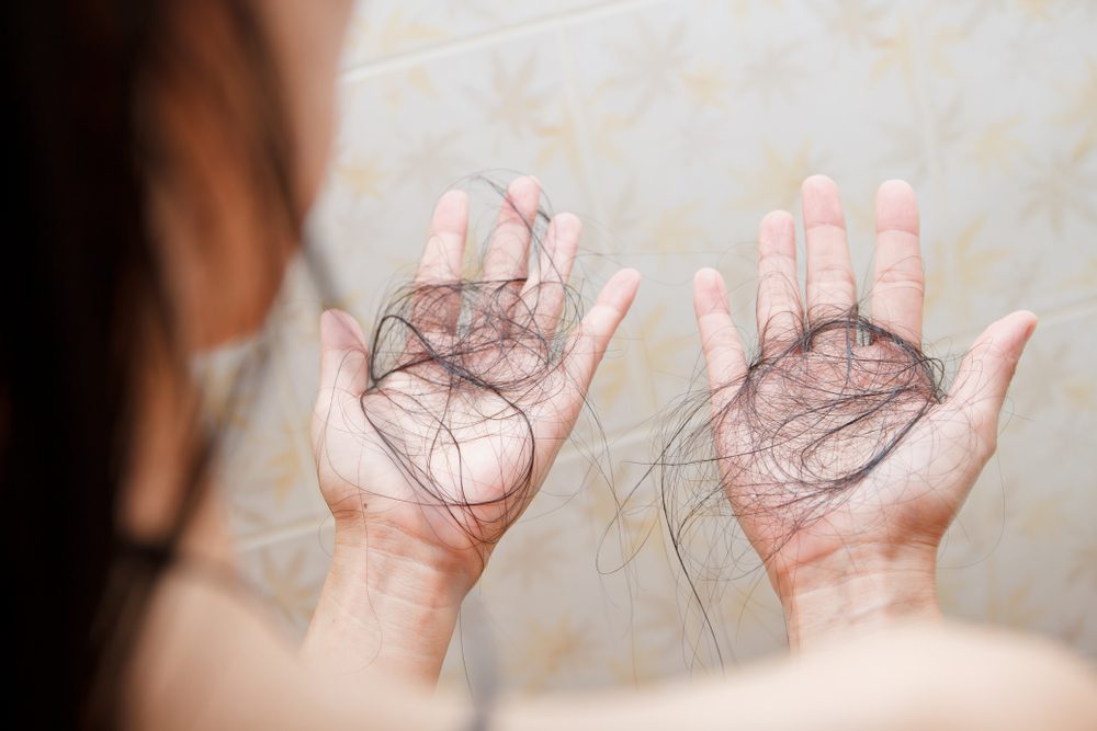 hair loss