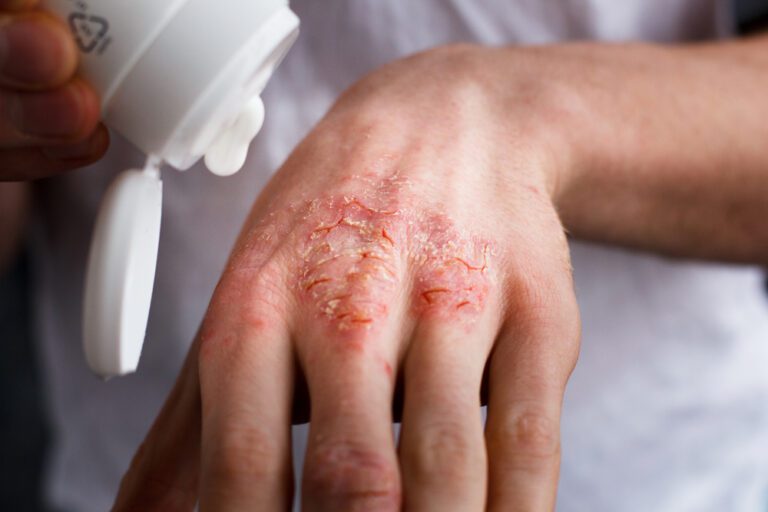 skin