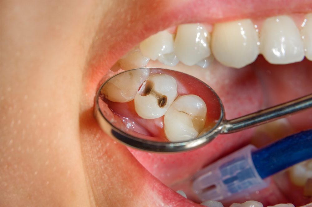 toothache
