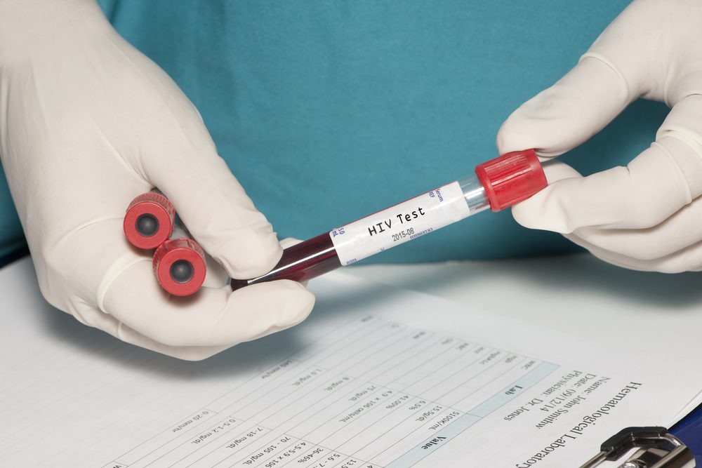 hiv