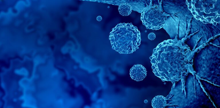 where cancer spreads
