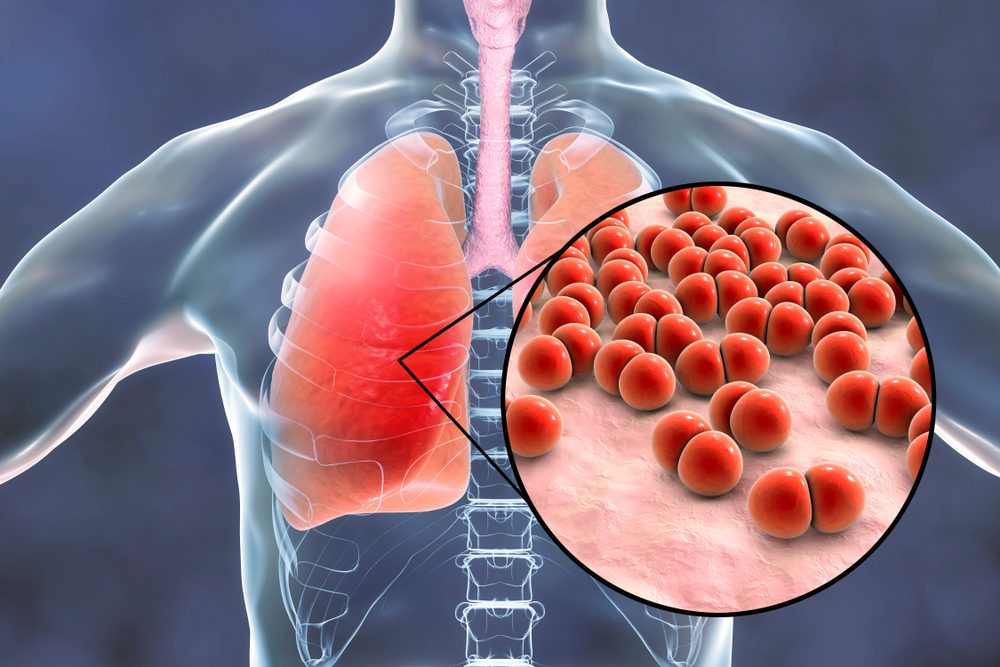 drug-resistant diseases