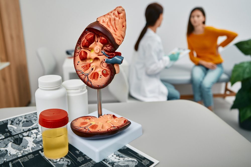 symptoms of kidney stones