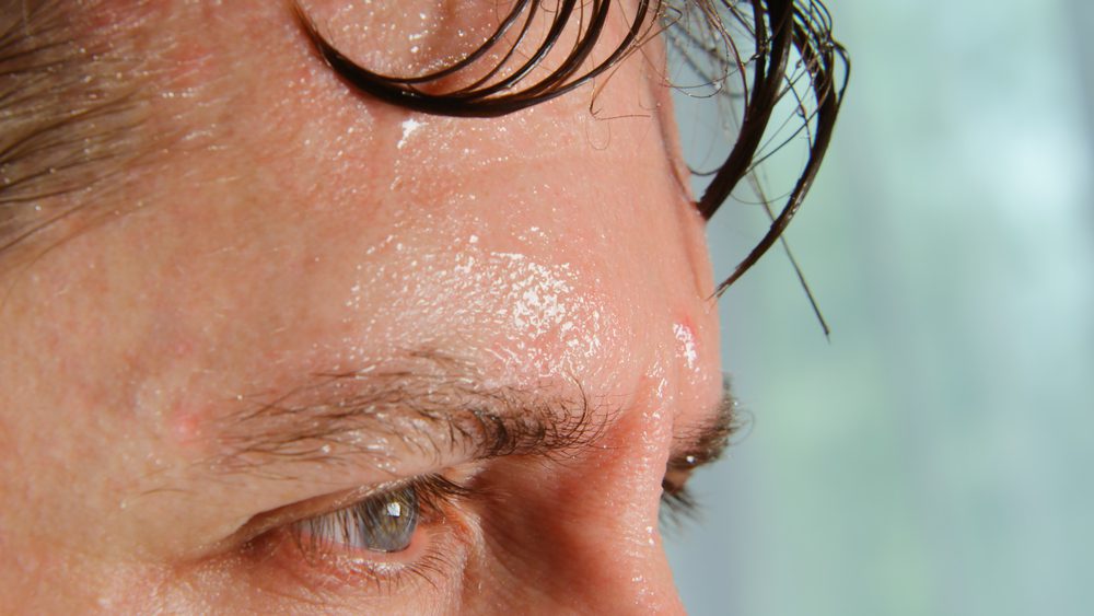 sweating too much