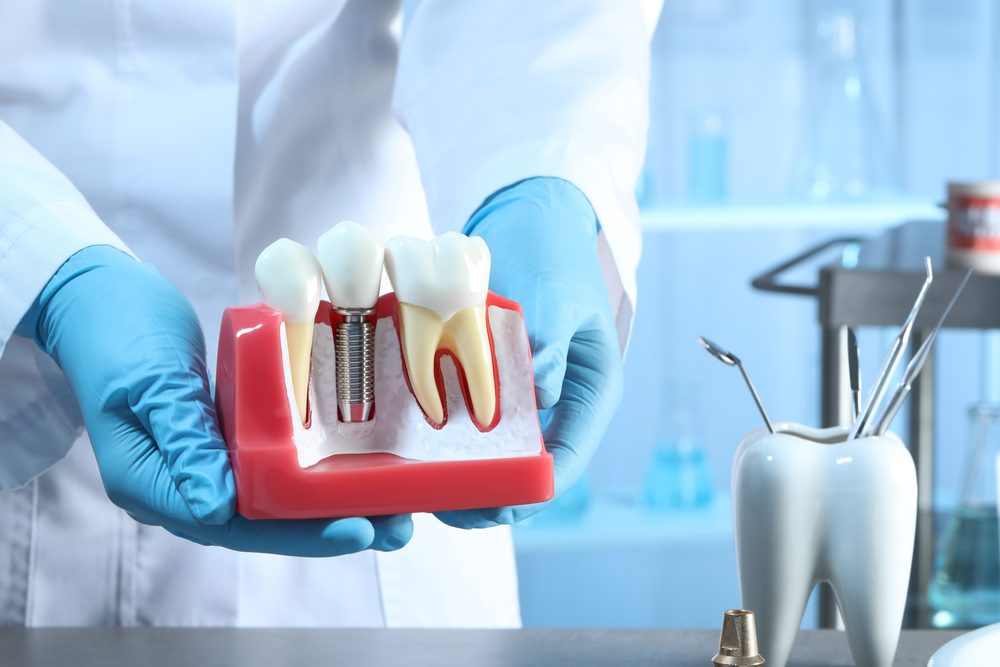 dental implant failure