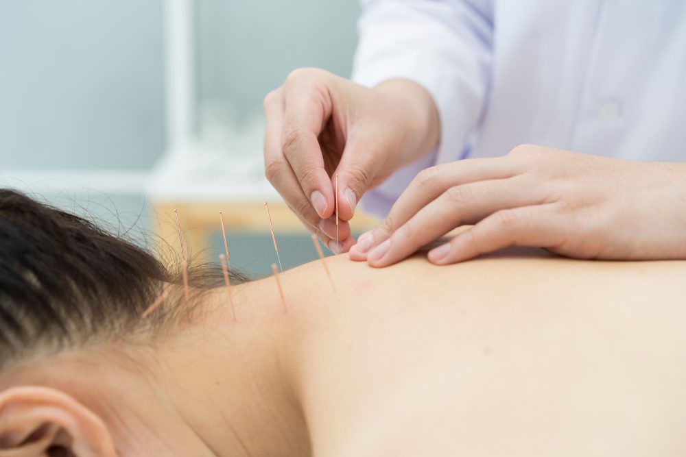 Acupuncture Benefits For Arthritis