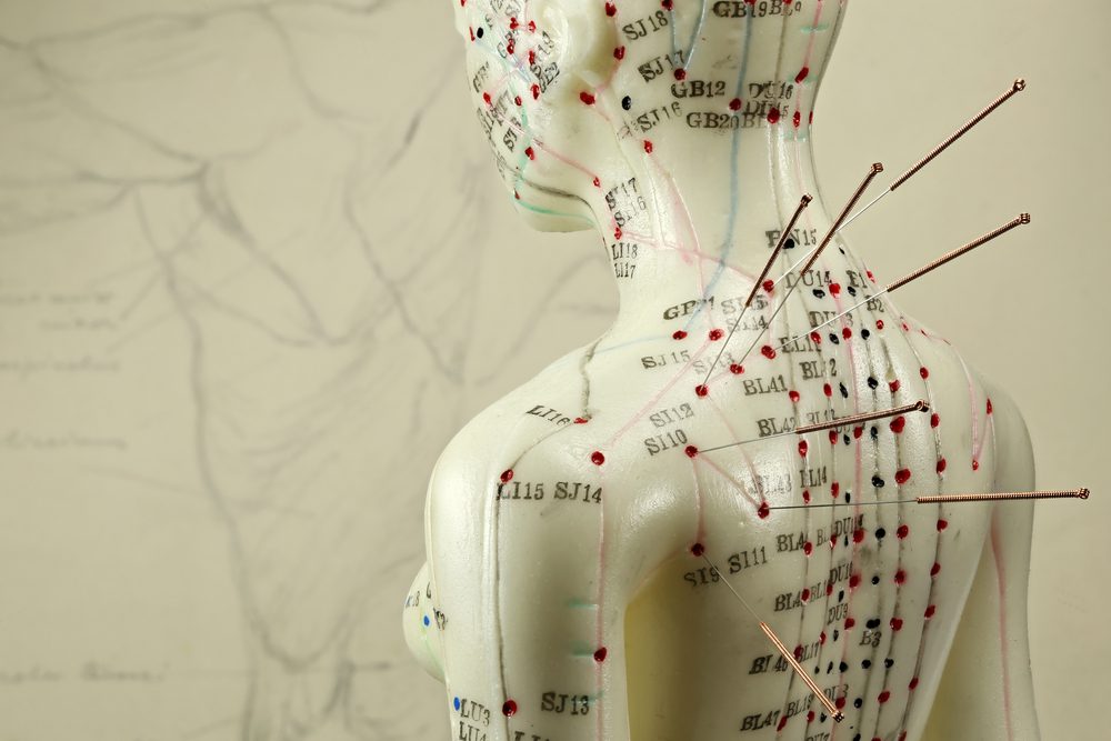 Acupuncture Benefits For Arthritis