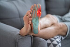 Foods For Gout Relief
