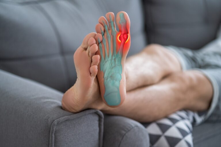 Foods For Gout Relief