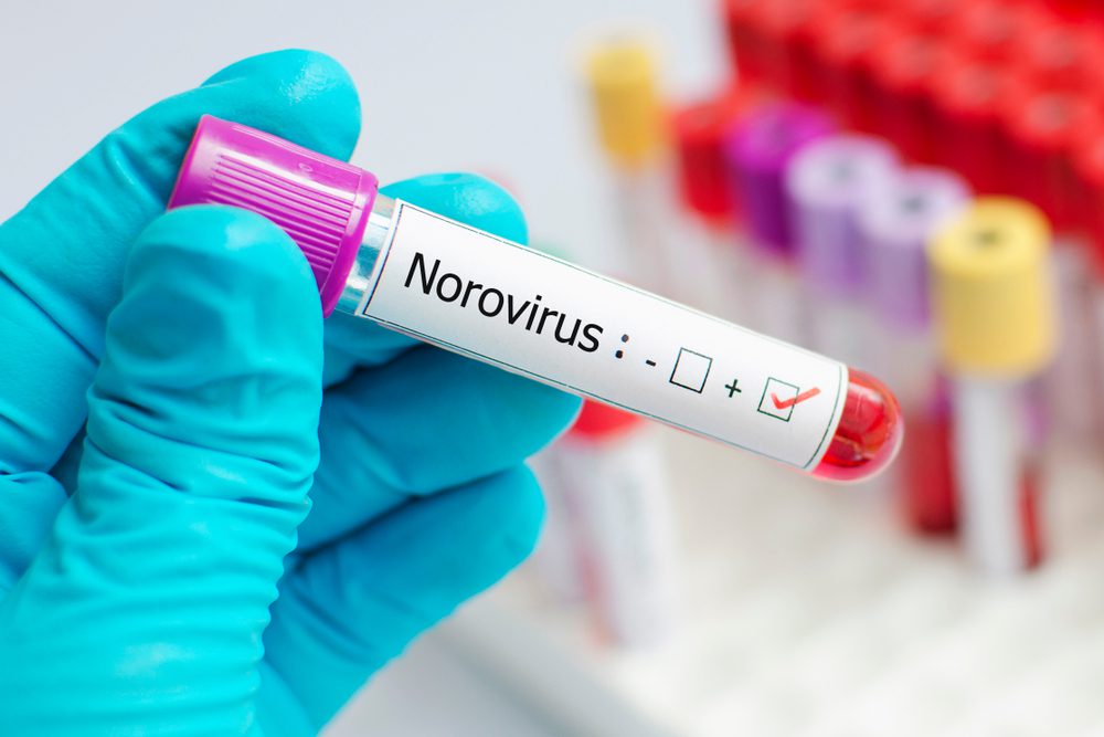 24-hour flu