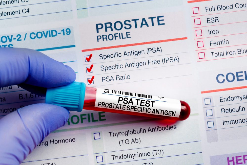 enlarged prostate