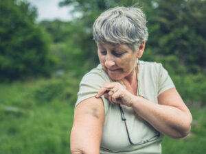 Skin, Aging