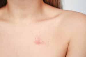 skin