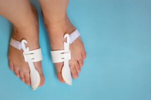 bunion relief