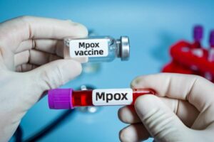 Monkeypox Strain