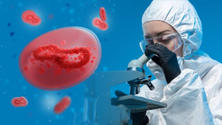 Monkeypox Strain