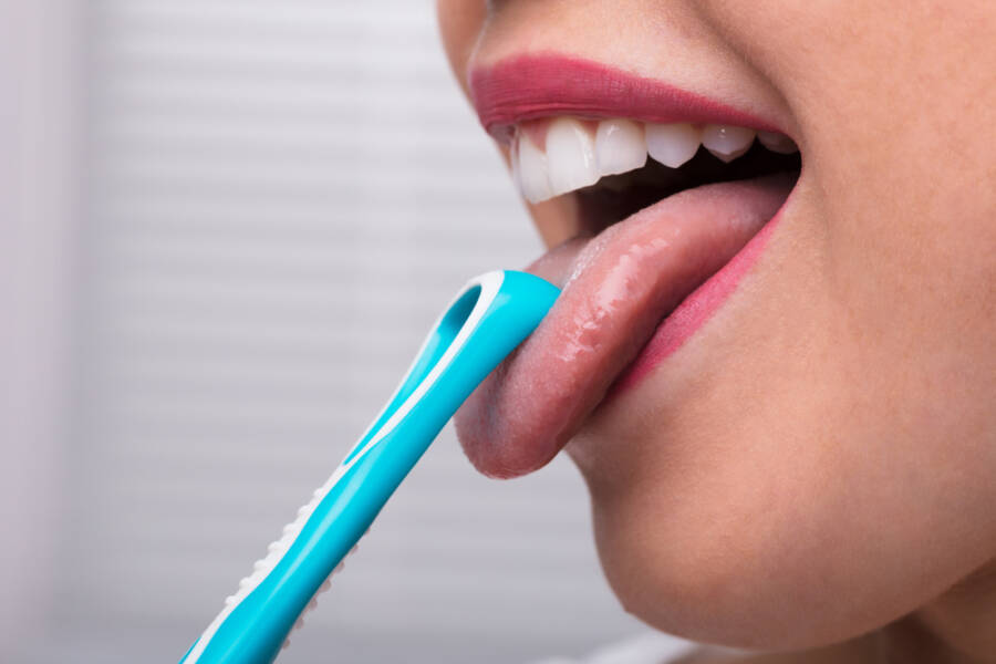 Bad Breath