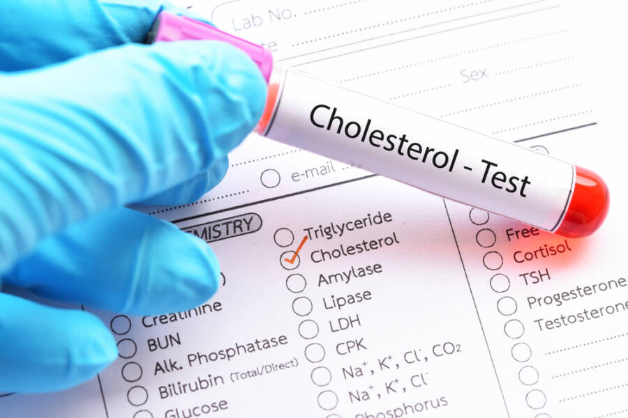 Cholesterol kidney