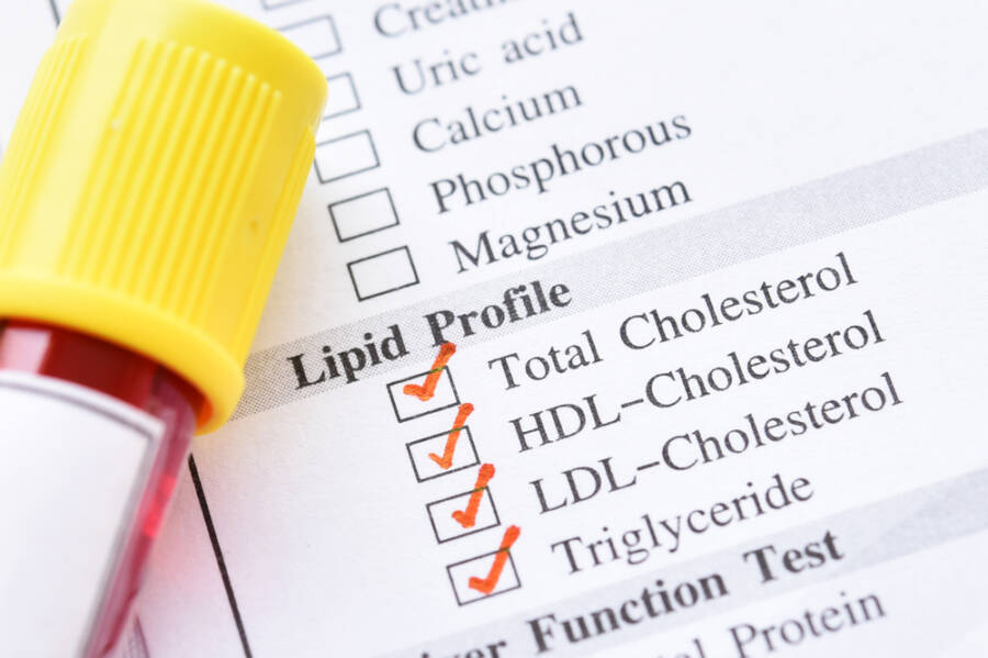 Cholesterol