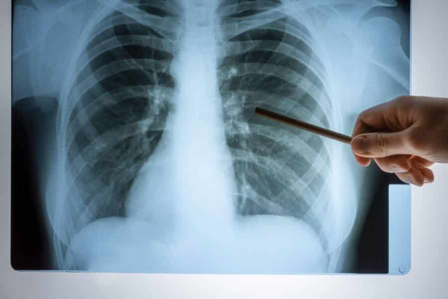antibiotic-resistant bacteria