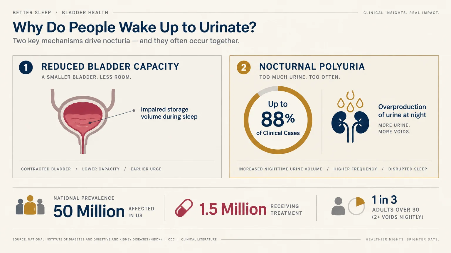 Infographic detailing two mechanisms of nocturia: reduced bladder capacity and nocturnal polyuria, alongside US prevalence stats.