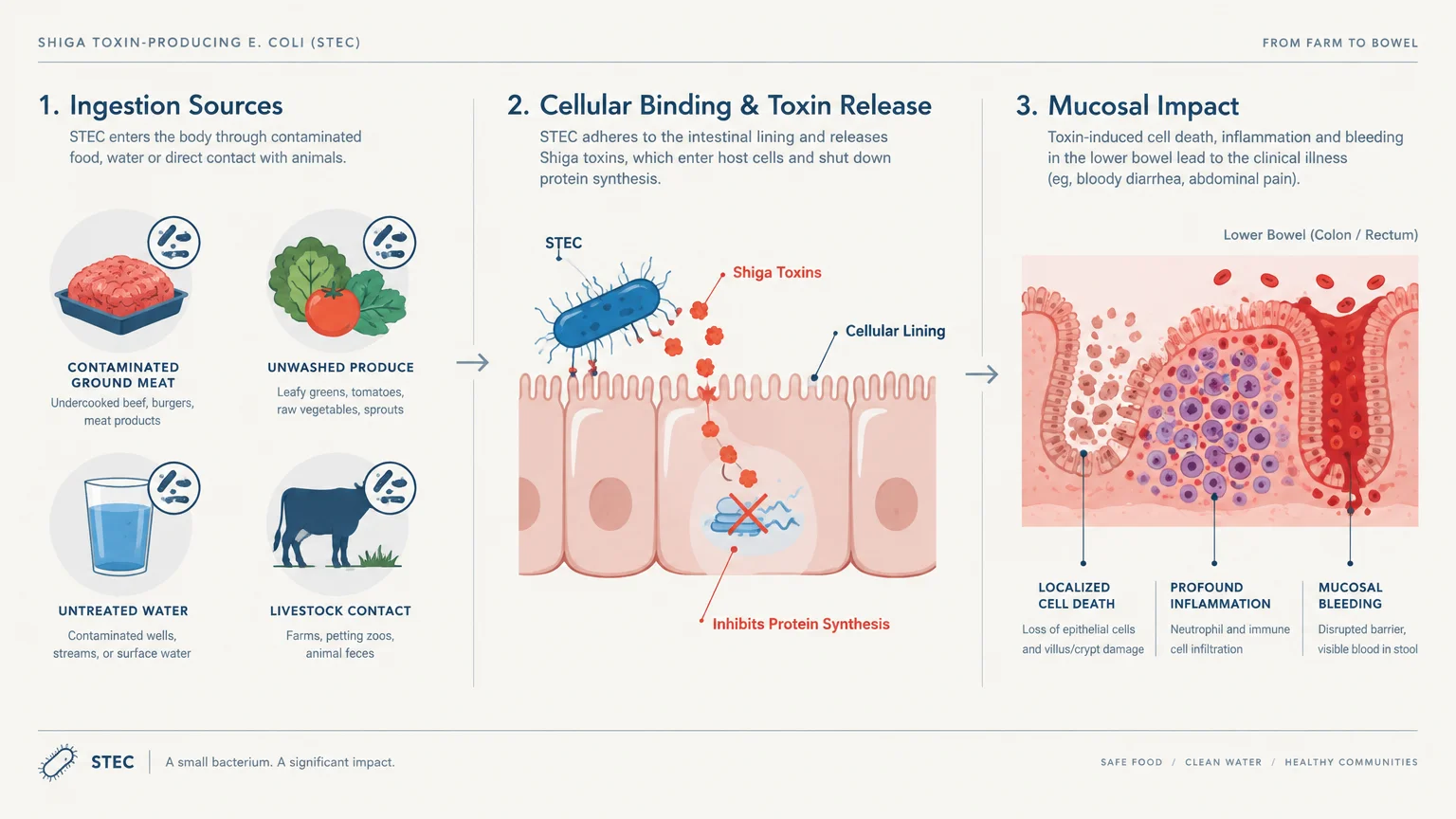 Medical infographic showing three stages of STEC infection from ingestion sources to toxin release and mucosal impact.